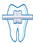 Ортодонтия зубов в Мурино